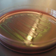 Image for article titled This Technology Can Prevent a Superbug Apocalypse
